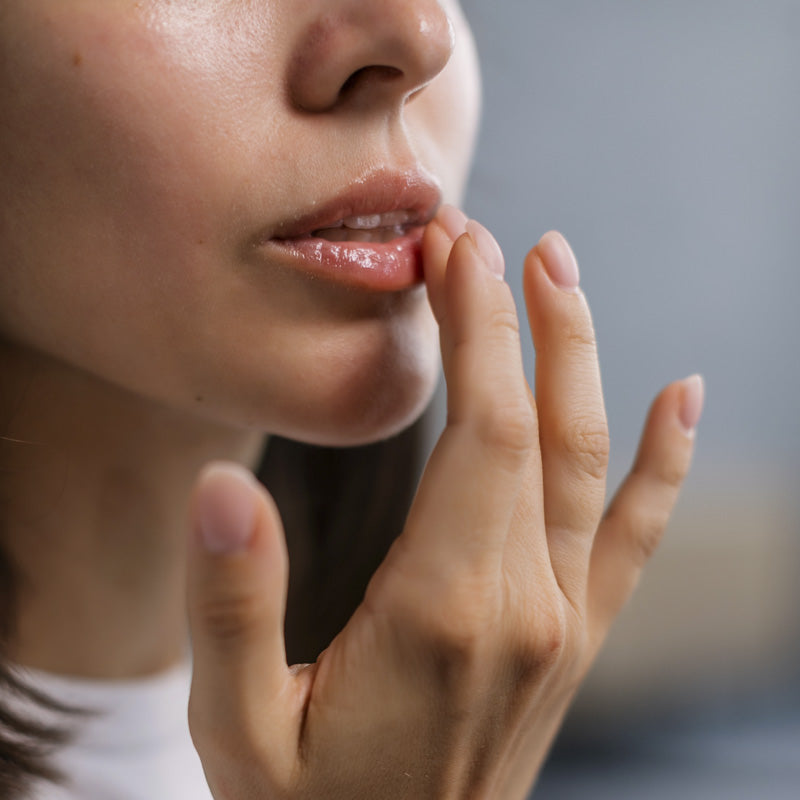 Come curare le labbra screpolate: i migliori rimedi