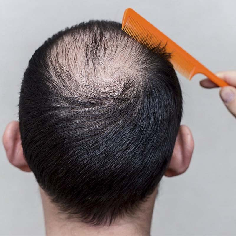 Quanti capelli cadono al giorno?